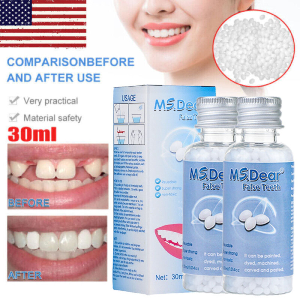 2X False Teeth Solid Glue Temporary Tooth Repair Moldable Teeth Gap Filler 60ml