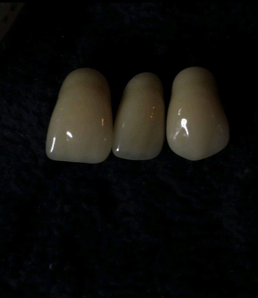 Multi-layer Composite Resin Teeth Dental Laboratory. Includes 20 full sets