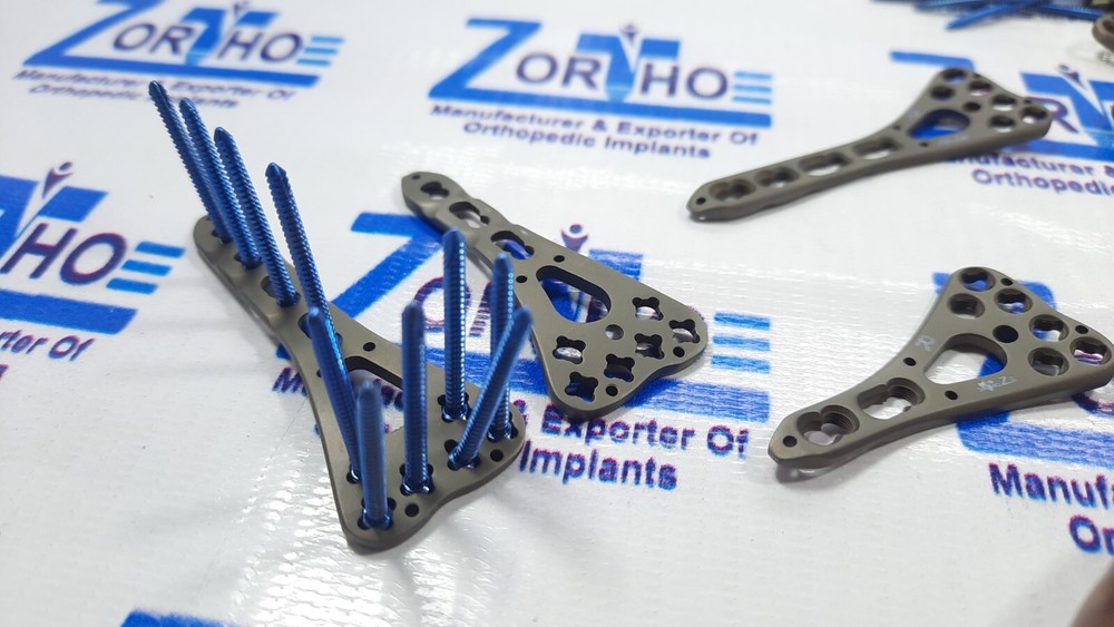 Locking Variable Angle Distal Radius Volar plate 2 to 5 L &R & screw 79 pc Titan