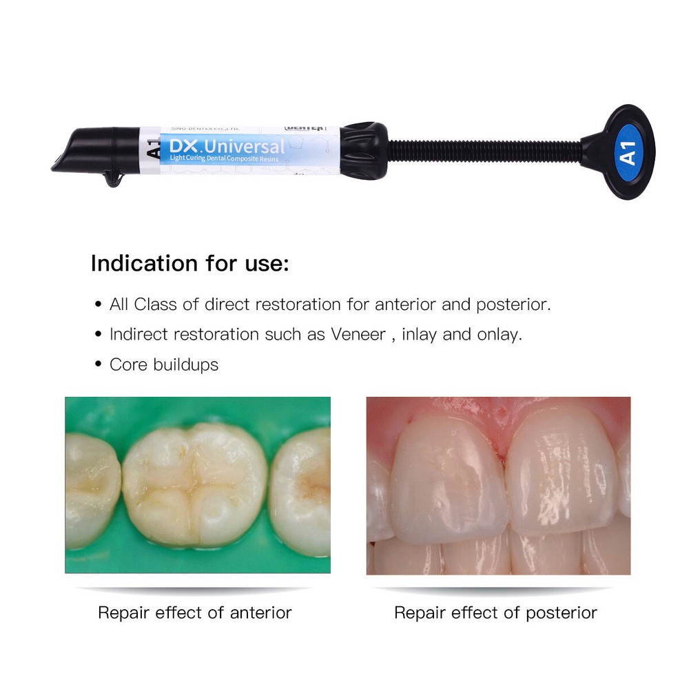 Dentex Dental Light Cure Composite Resin Refill Syringe Shade A1 A2 A3 A3.5 B1