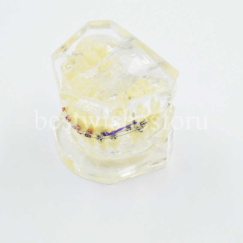 Dental Malocclusion Treatment Teeth Model Study Typodont Elastic chain 3005-2