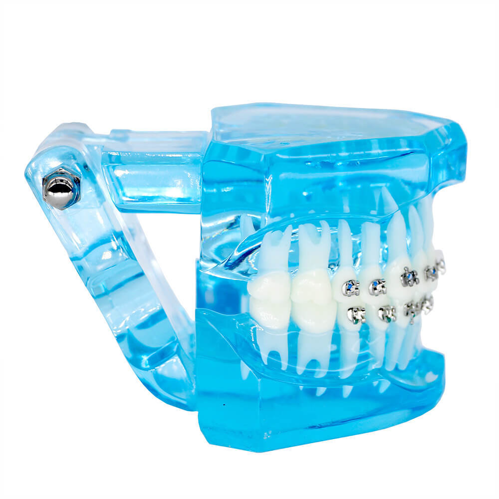 Dental orthodontic teach study teeth model mental and ceramic bracket contrust