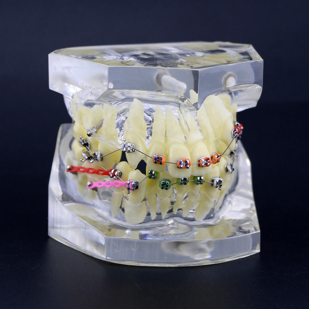 Dental Typodont Orthodontic Treatment Teeth Model Malocclusion Study w/ Bracket