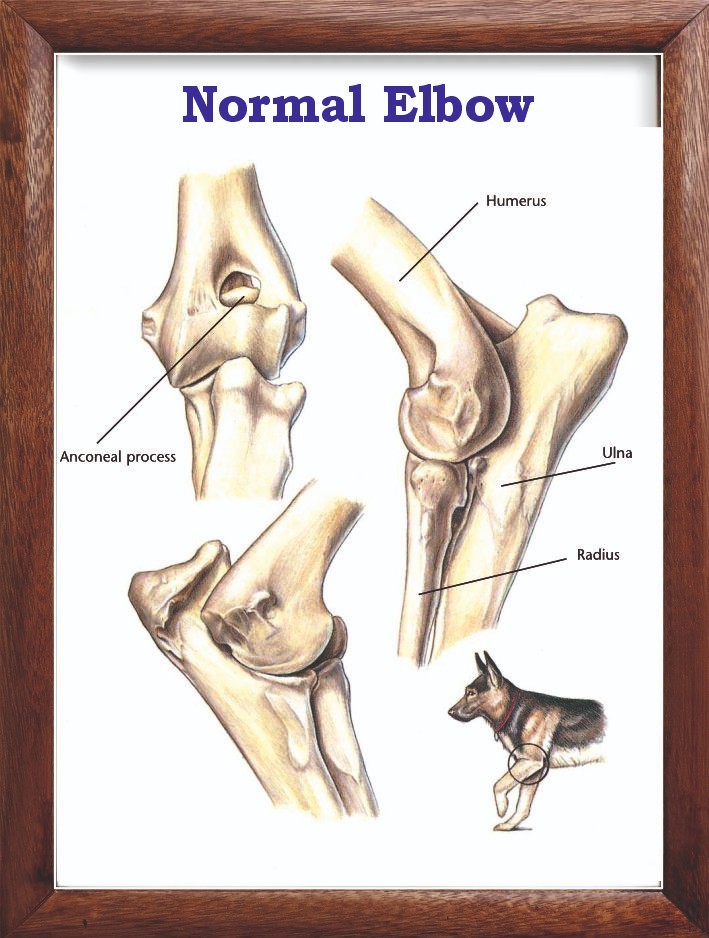 Normal Elbow Chart 12x18 inches