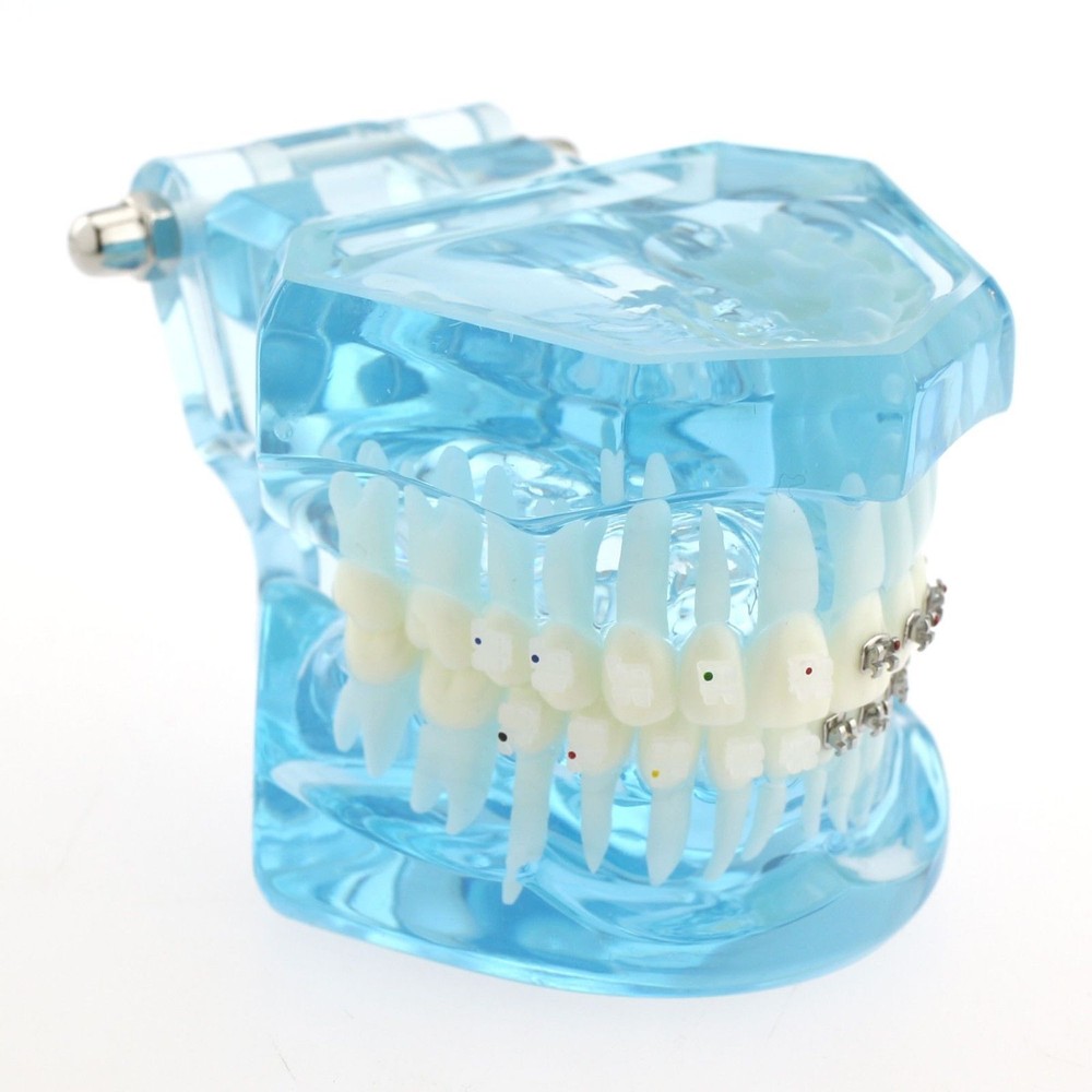Dental Teach Study Typodont Teeth Model Half Metal Bracket Half Ceramic Bracket