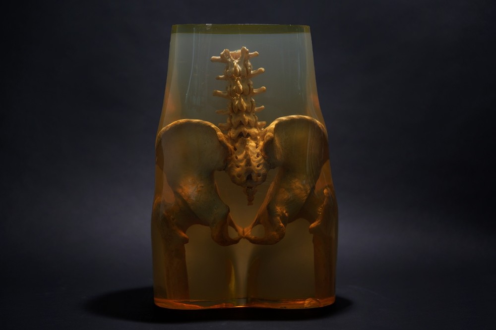 3M Xray Calibration Phantom Pelvis C.1960's