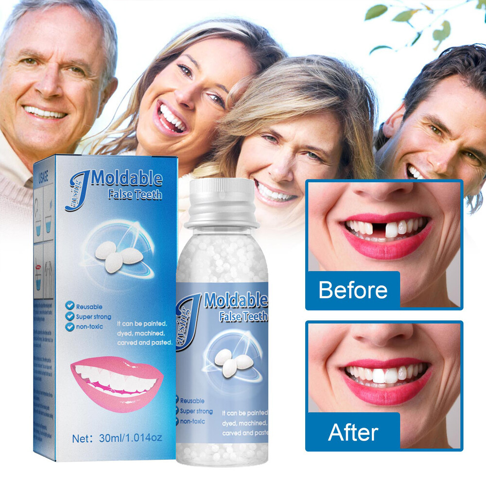 Tooth Repair Granules Temporary Kit Fitting Beads Reusable Moldable False Teeth