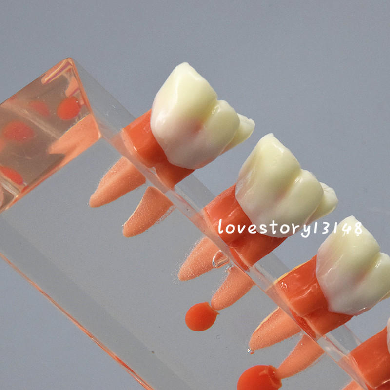 1 Set Dental Teeth Model #4018 01 - 4-Stage Endodontic Treatment Study Model