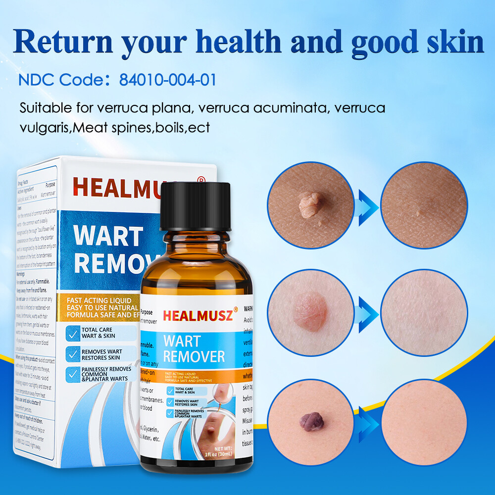 2Pack Wart Remover Liquid Skin Tag Mole Remover Eliminate Feet Corn Wart Remove