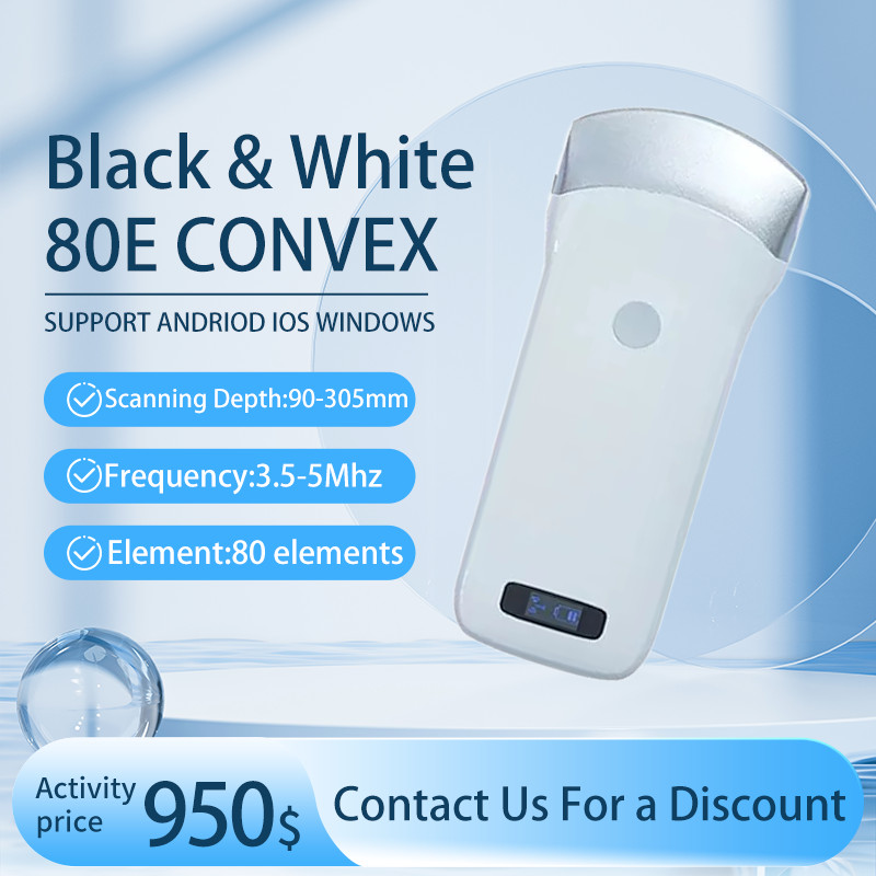IOS Android Windows 80 Elements Convex Array Wireless Ultrasound Scanning Probe
