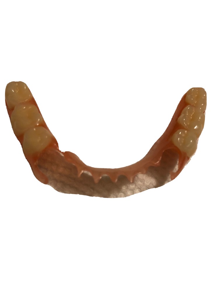 BURBANK Replacement DentalLab Partials Lower Side 6 teeth CustomMadeMissingTooth