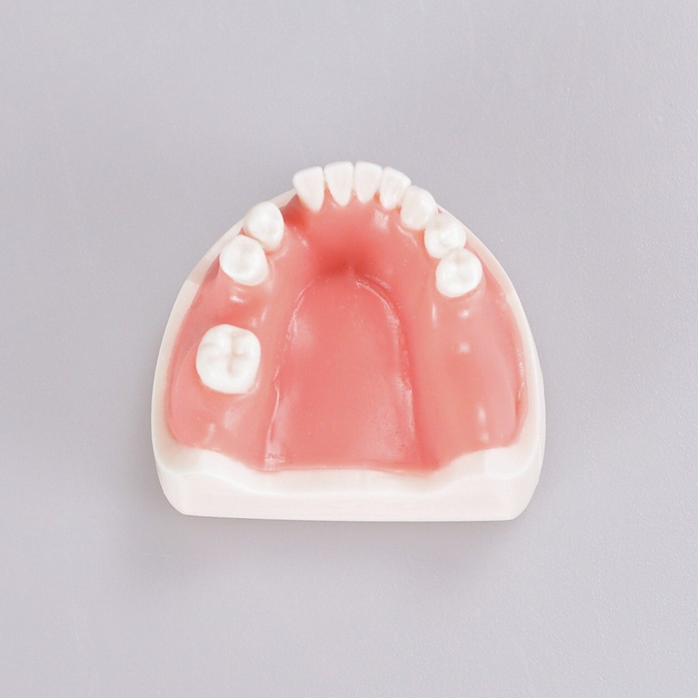Dental Teeth Missing Implanting Typodont Training Dentistry Model Display