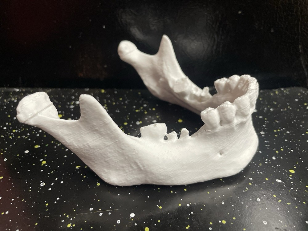 3D PRINTED HUMAN 3d JAW BONE