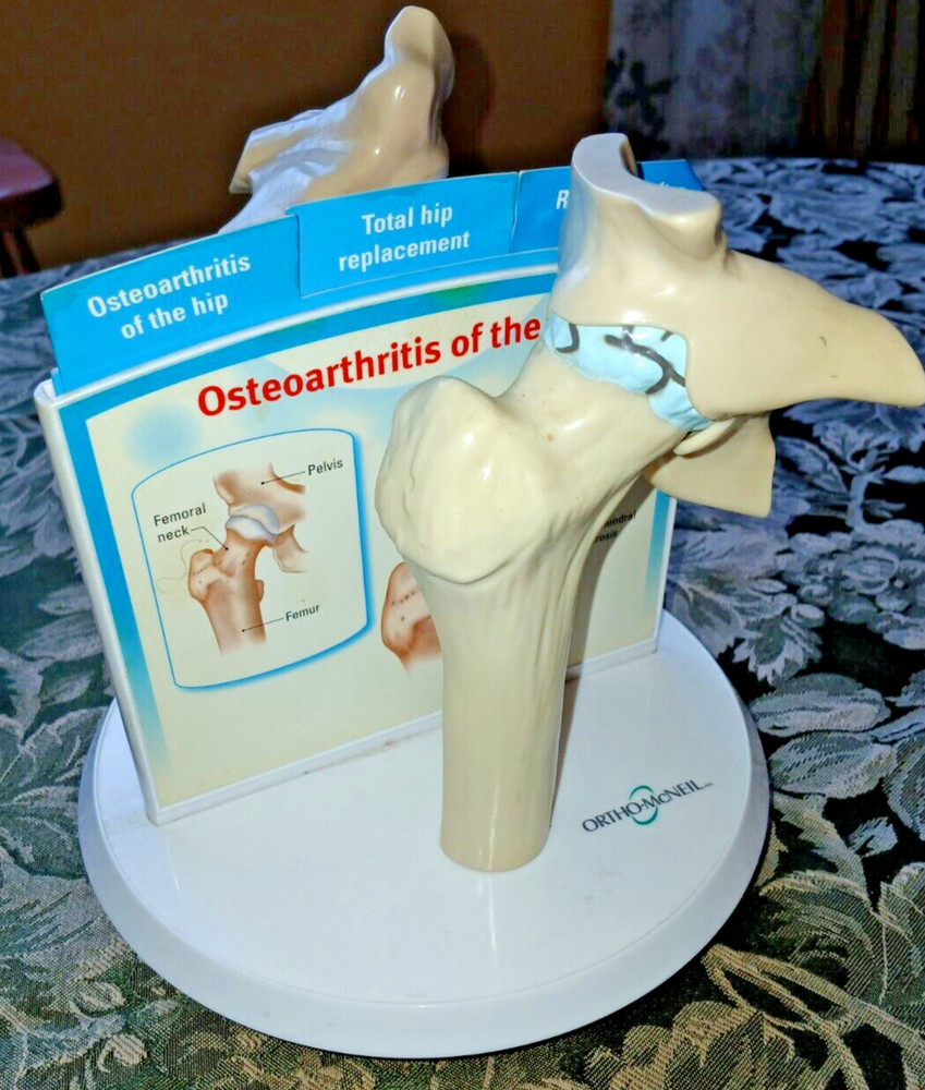 Anatstat ARTIFICIAL HIP JOINT REPLACEMENT Medical Anatomical Skeleton DEMO MODEL