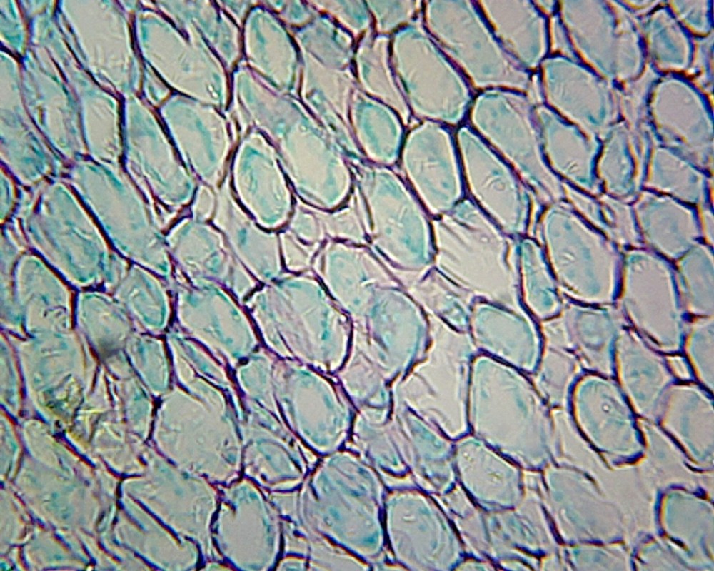 Iris Root; Typical Monocot Root; Cross Section