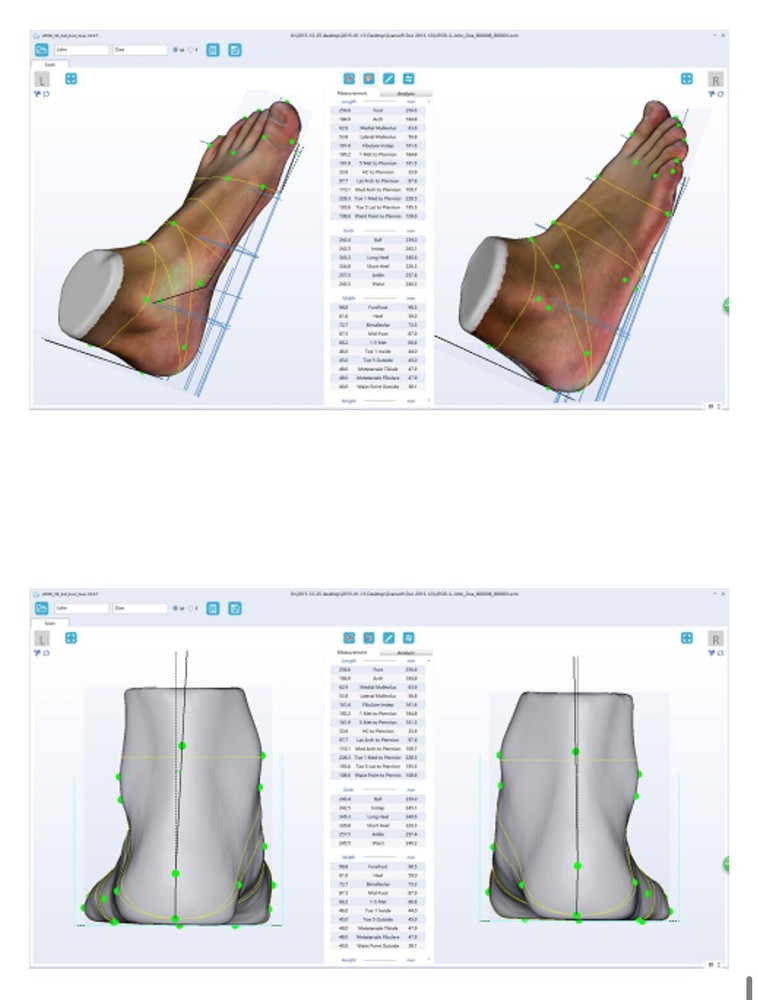 UPOD 3D Foot Scanner
