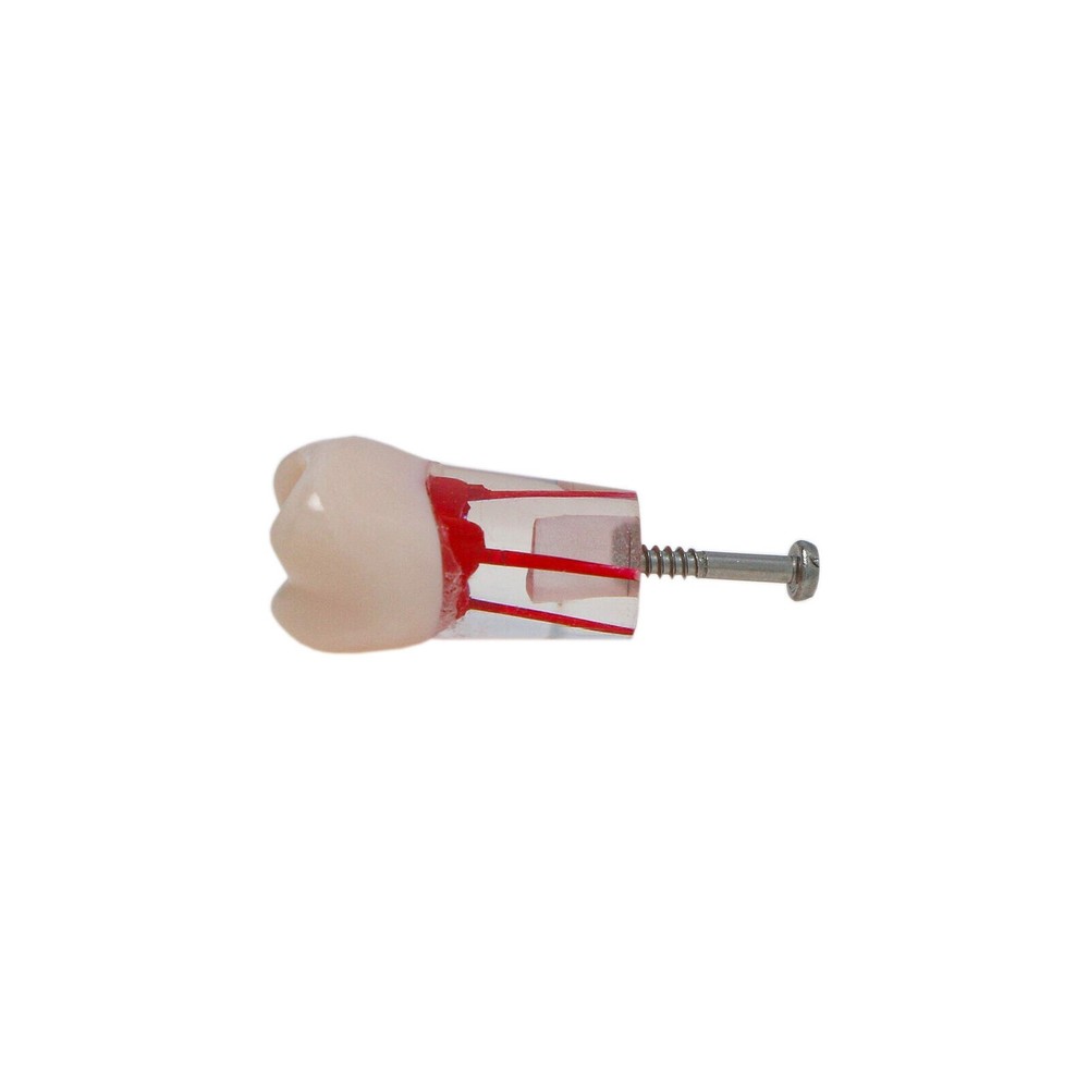 10Pcs/Set Dental Endo Root Canal Teeth Model Study RCT Practice Typodont Model