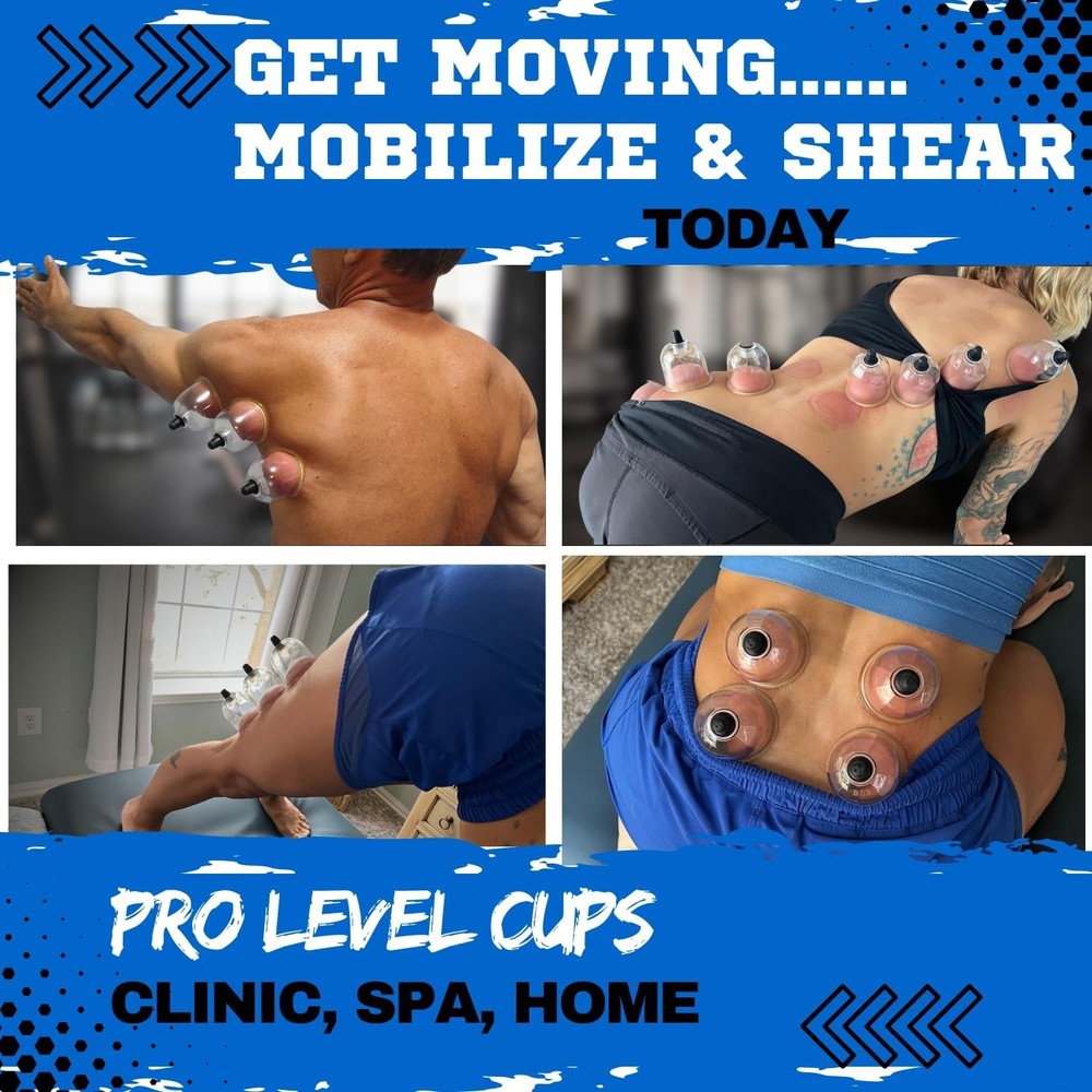 Cupping Warehouse 20 Poly Professional Cupping Set – Durable Cups with Sec