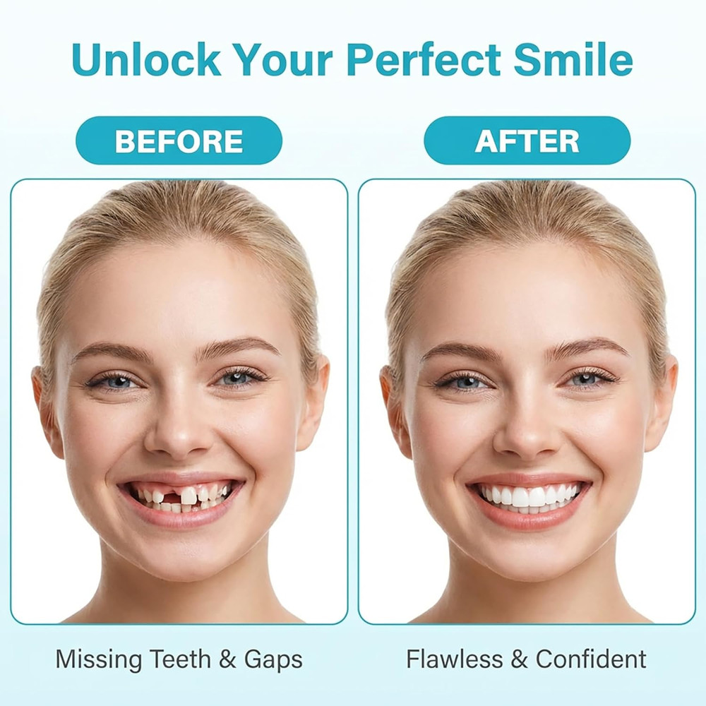 100G Bead Teeth Tooth Solid Gel Replacement Moldable Thermal Fitting Bead Teeth