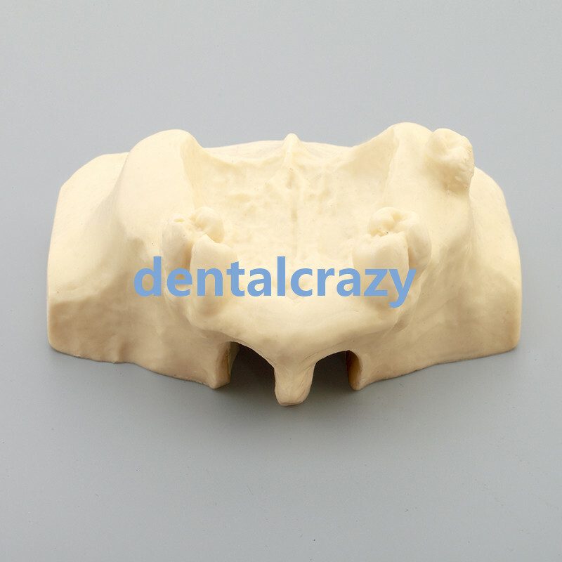 Dental Sinus Lift Practice Teeth Model Typodont Study Model 2013F