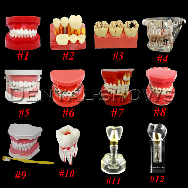 Dental Implant Study Model Analysis Demonstration Tooth Teaching Orthodontics