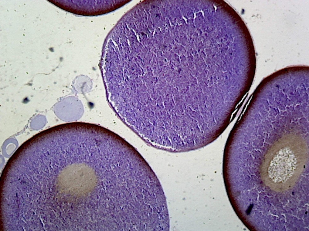 Frog Ovary; Section; H&E Stain