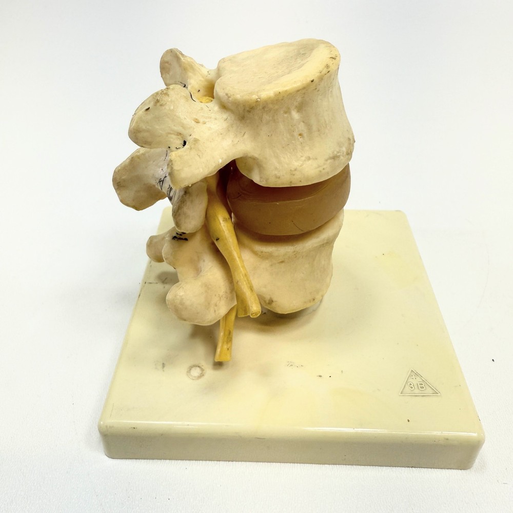 Lumber Vertibrae Model with Disc on Stand