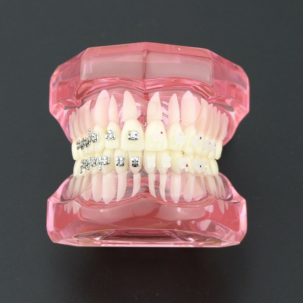 Dental Orthodontic Demonstration Ceramic and Metal Bracket Study Typodont Model