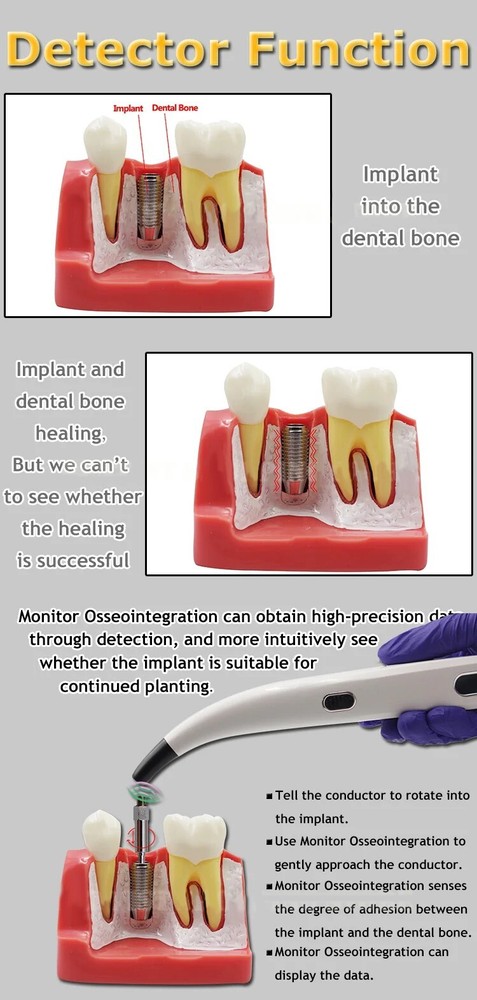 Monitor Osseointegration RFA Inplant Stability Test Unit