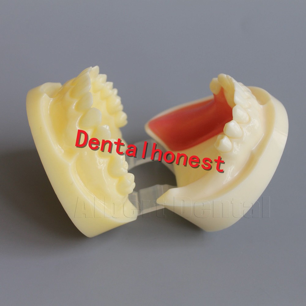 Great Dental Full Implant Drilling Practice Teeth Study Model Typodont Model