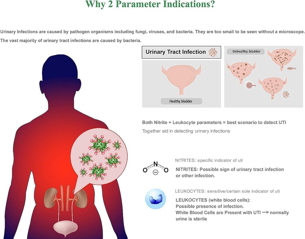 Quick 2-Minute UTI Strips - Accurate and Affordable Urinary Testing