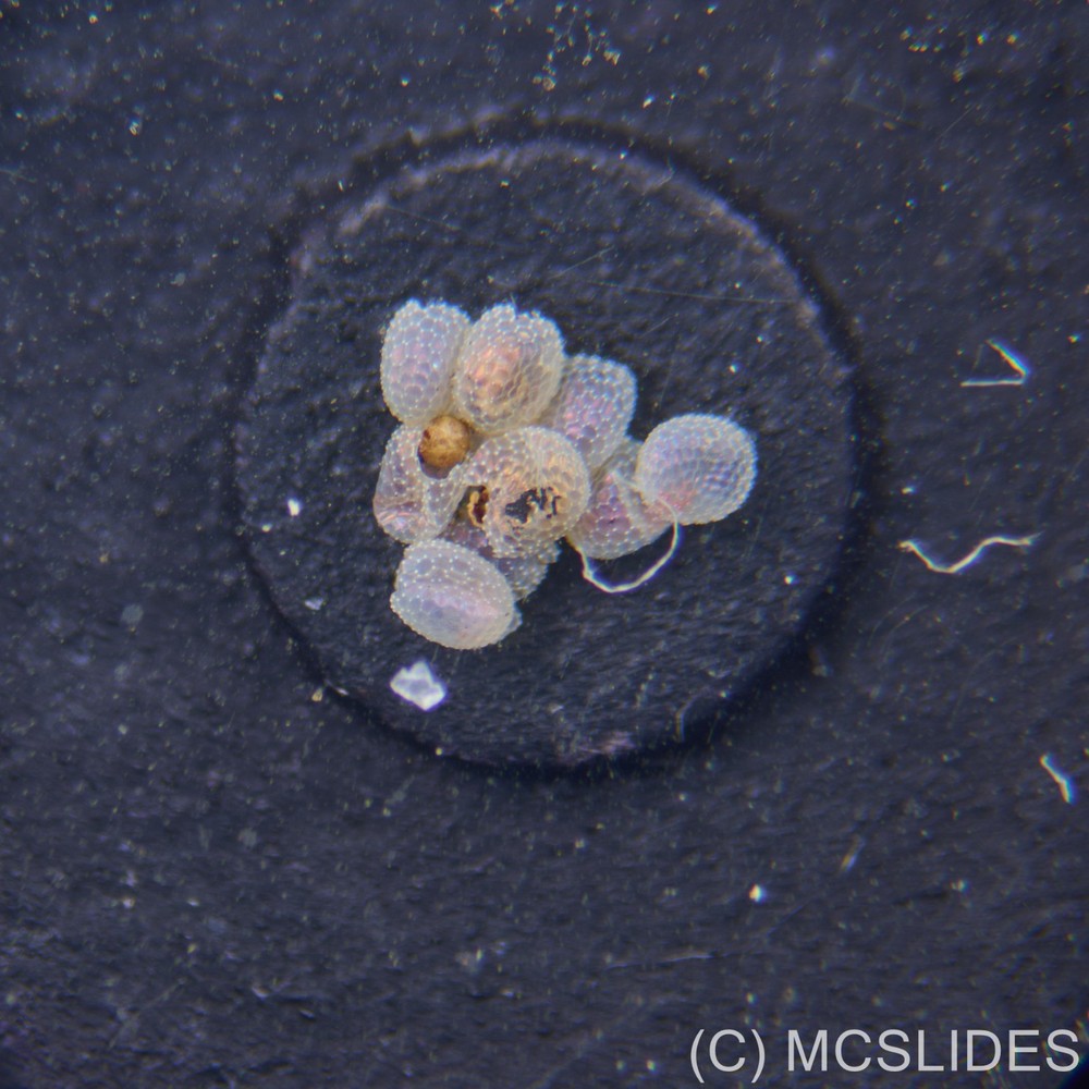 Vintage microscope slide: fluorescence moth eggs for reflected light
