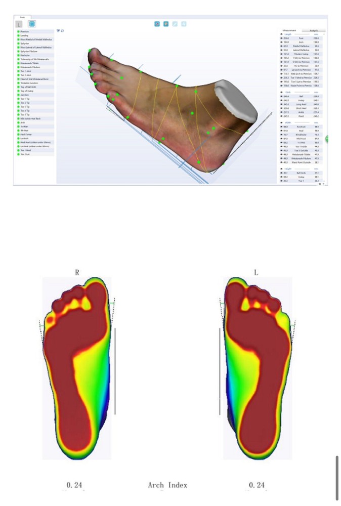 UPOD 3D Foot Scanner