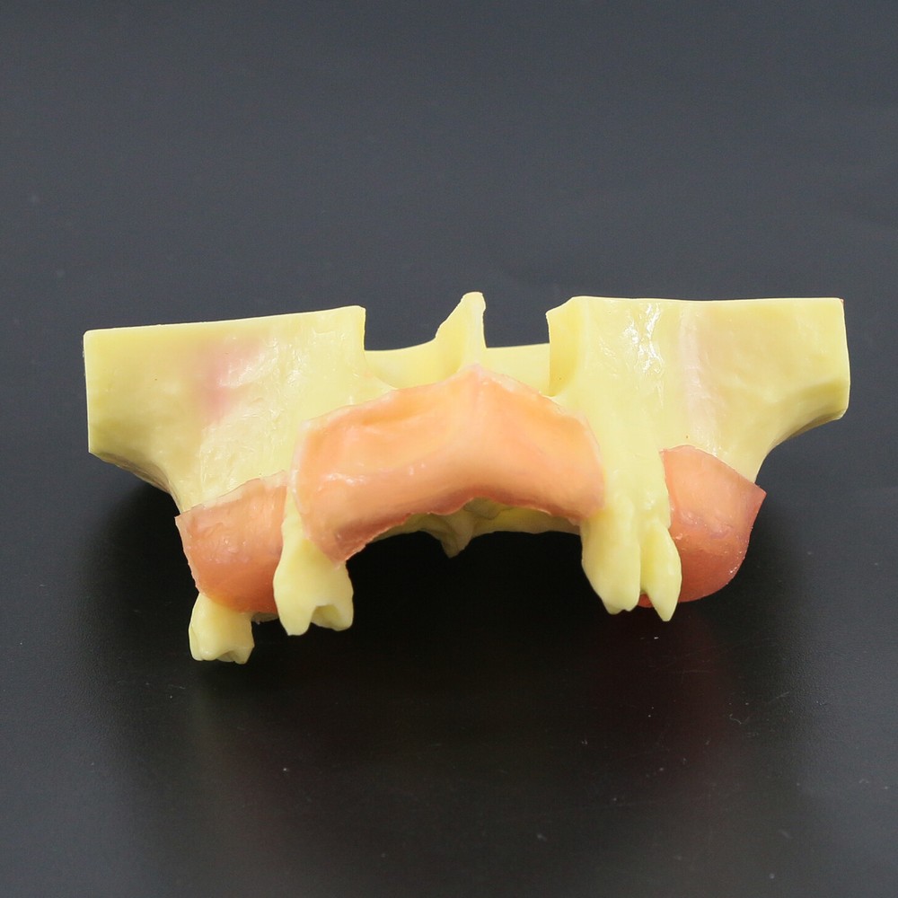 Dental Typodont Teeth Model Sinus Lift Practice Study Teach Demo Model 2012 2013