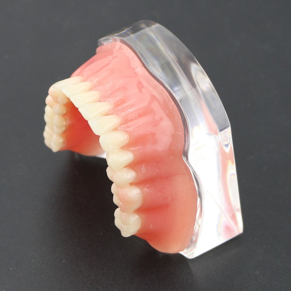 Detal Typondont Implant Teeth Model 4 Implants With Silver Golden Bar
