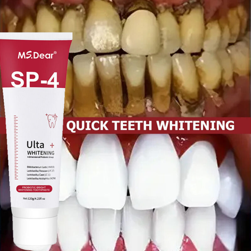 SP-4 Probiotic Whitening Toothpaste Refresh Mouth Brighten Remove Yellow Teeth
