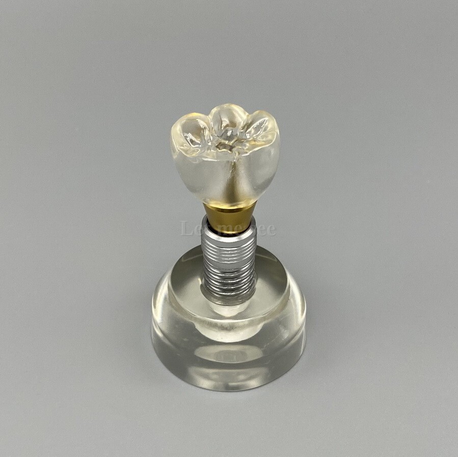 Dental Implant Model Detachable Demonstration Teeth Study Teach Model M2020