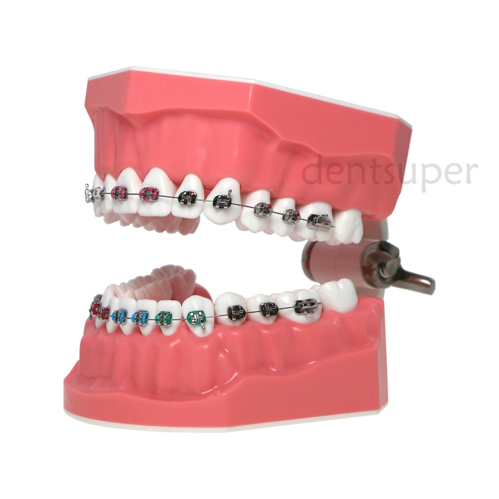 US 1:1 Dental Orthodontic Teeth Model Typodont Demonstration Model with Brackets