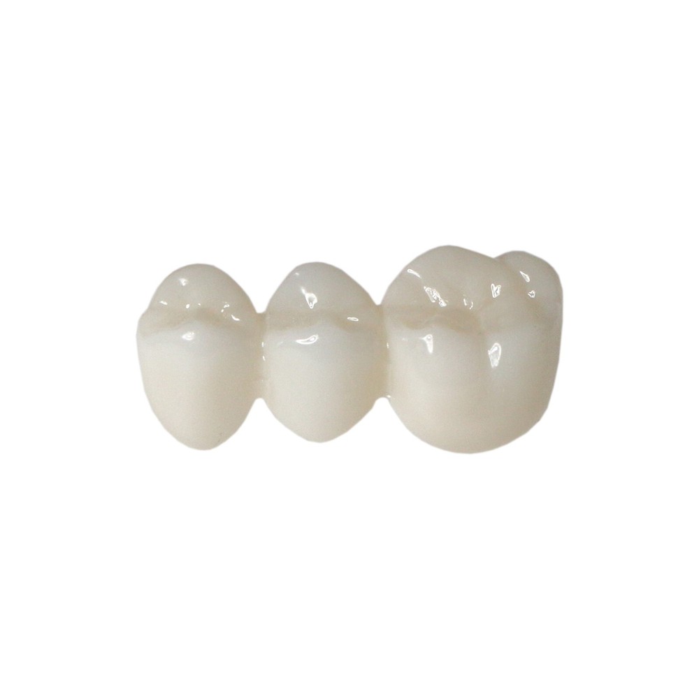Dental Implant Disease Teeth Model Overdenture Implants Upper/Lower Demo