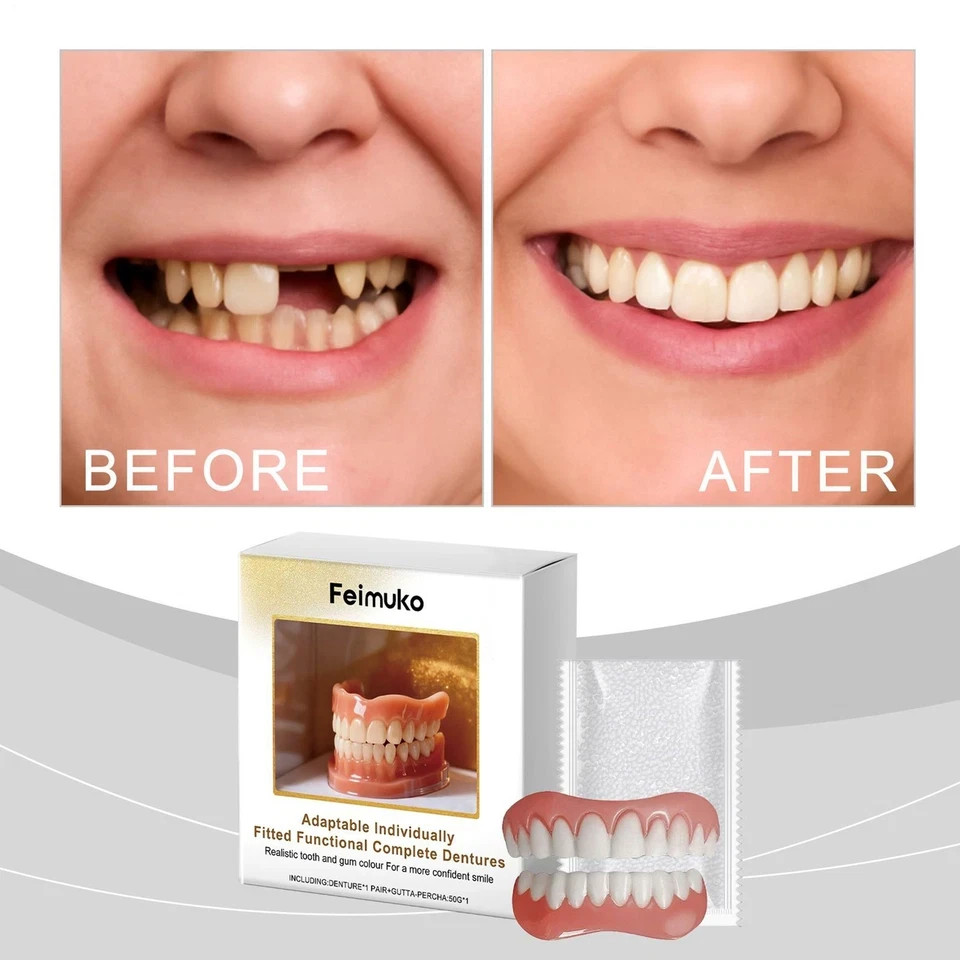 Full Denture Set Upper Lower False Teeth Replacement for Men Women