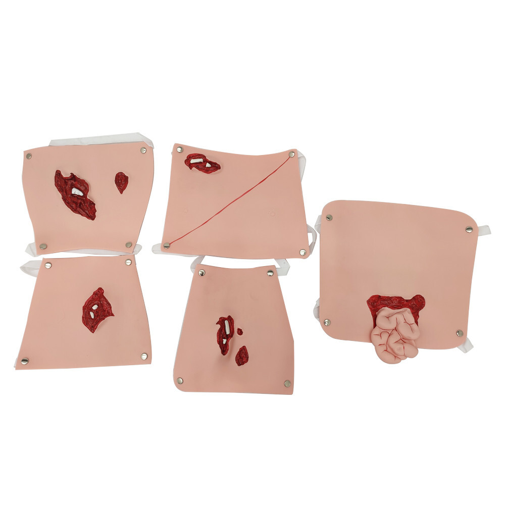 Patient Care Burn Teaching Model 24 Wound Modules Care NursingTraining Model