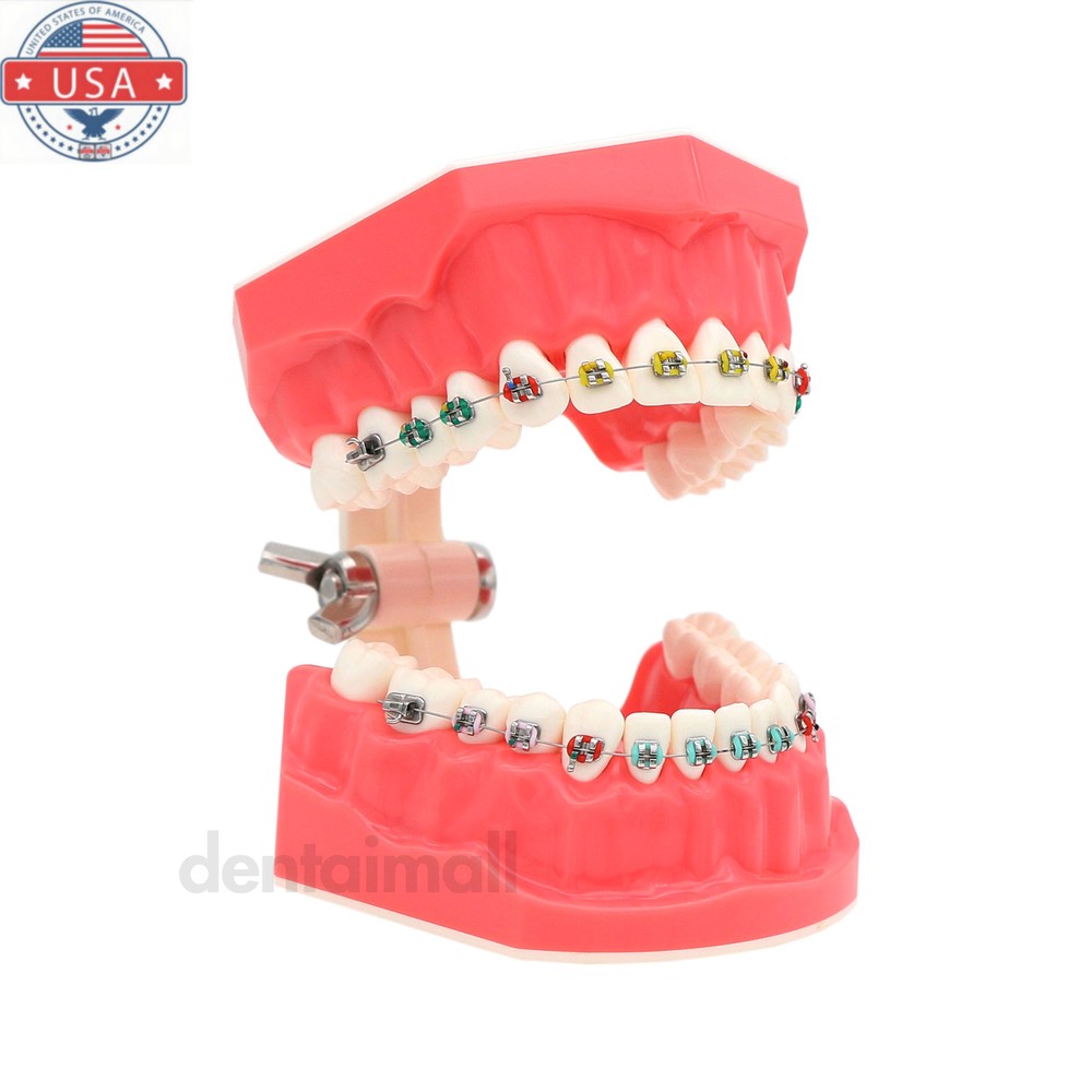 US Dental Typodont Demonstration Teach Teeth Model with Braces For Patient Study