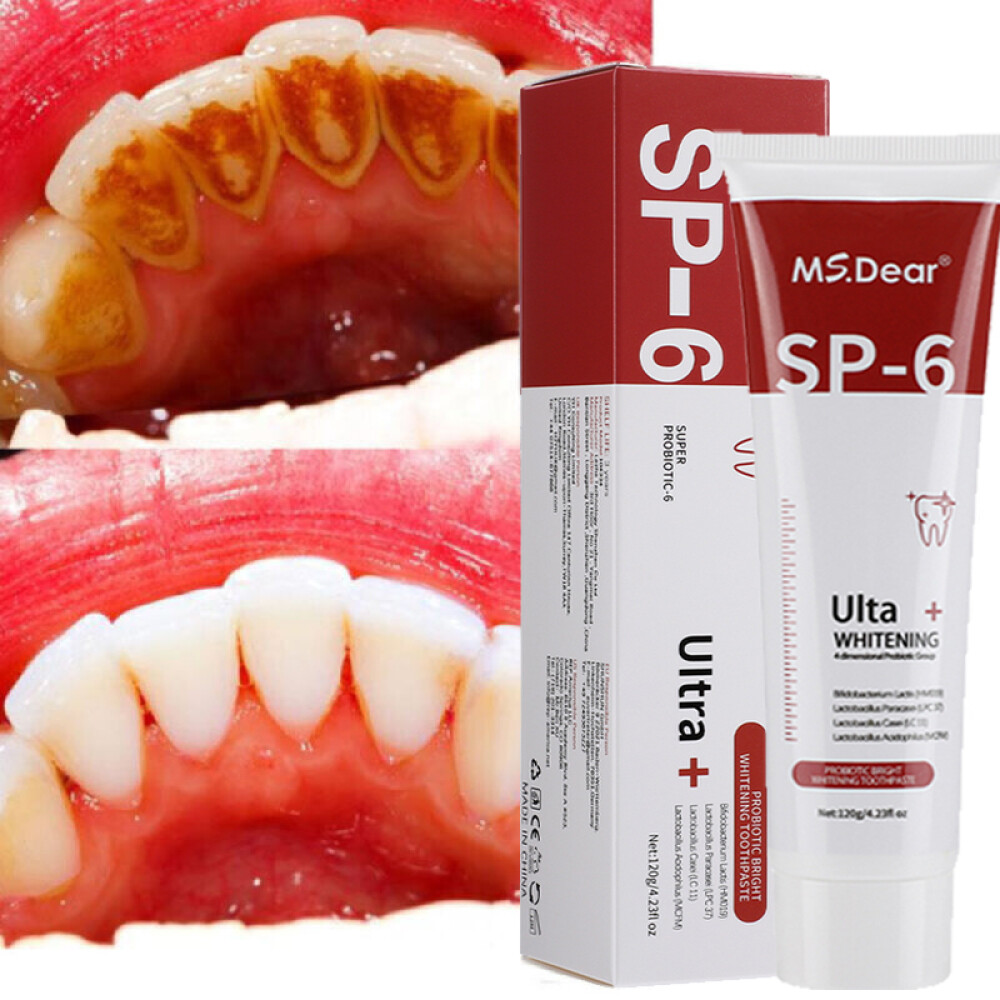 SP-6 Toothpaste, Whitening Sp-6 Toothpaste, Sp-6 Probiotic Whitening Toothpaste