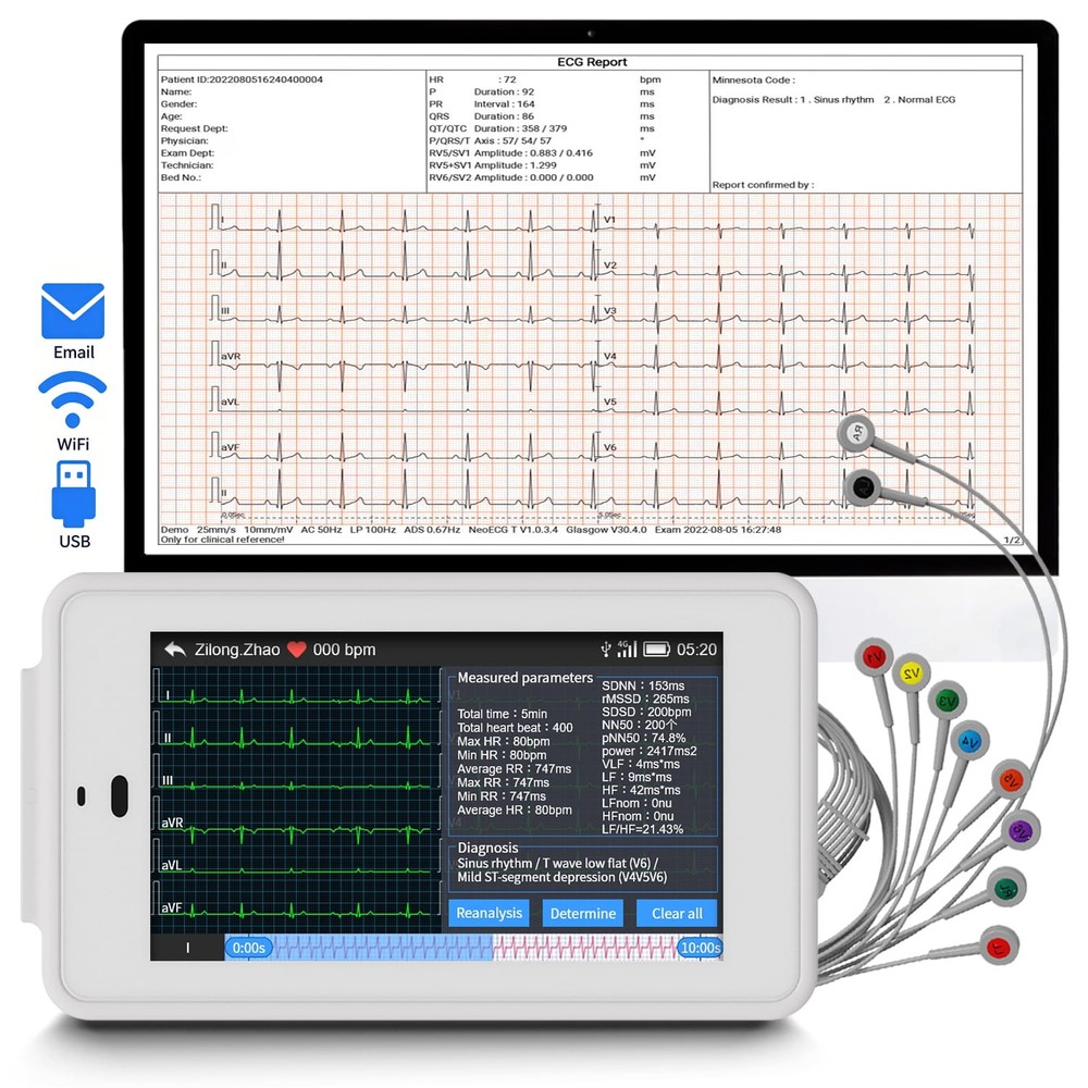 12-Lead ECG Machine Diagnostic Automatic Interpretation data transfer via email