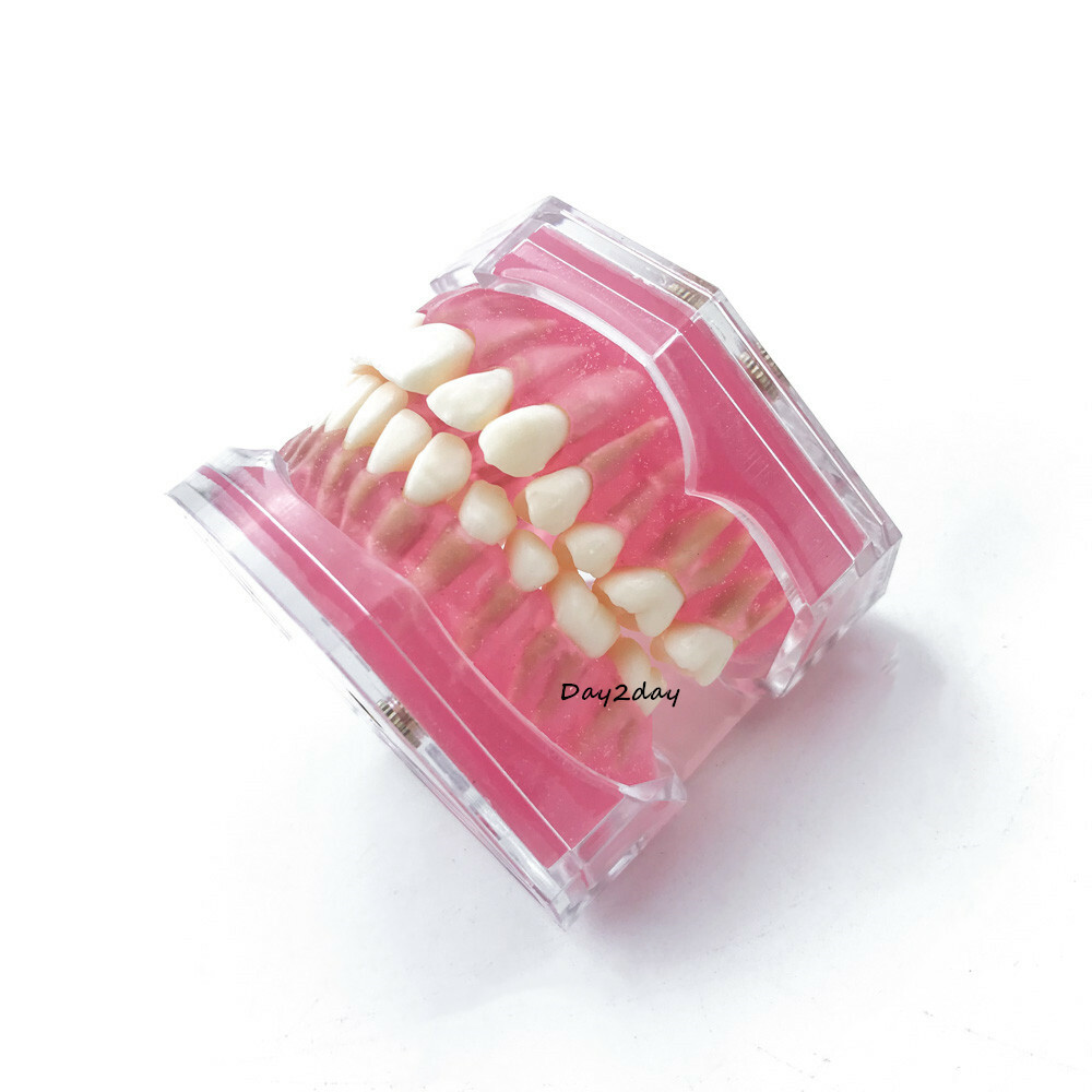 Teeth Model Dental Standard Model with Removable Teeth Dental Study Model