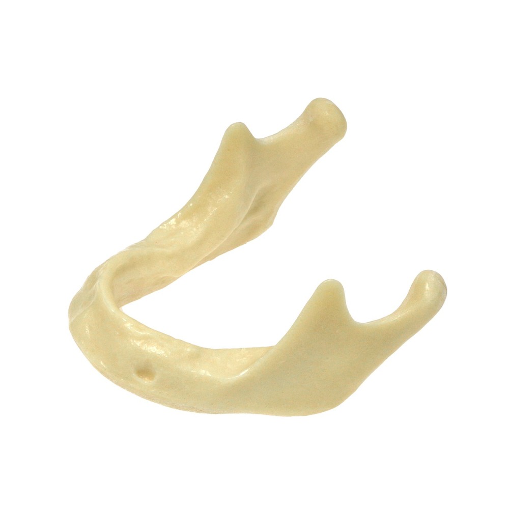 Dental Implant Jaw Bone Model For Practice Basic Drilling Insertion M2022/2023