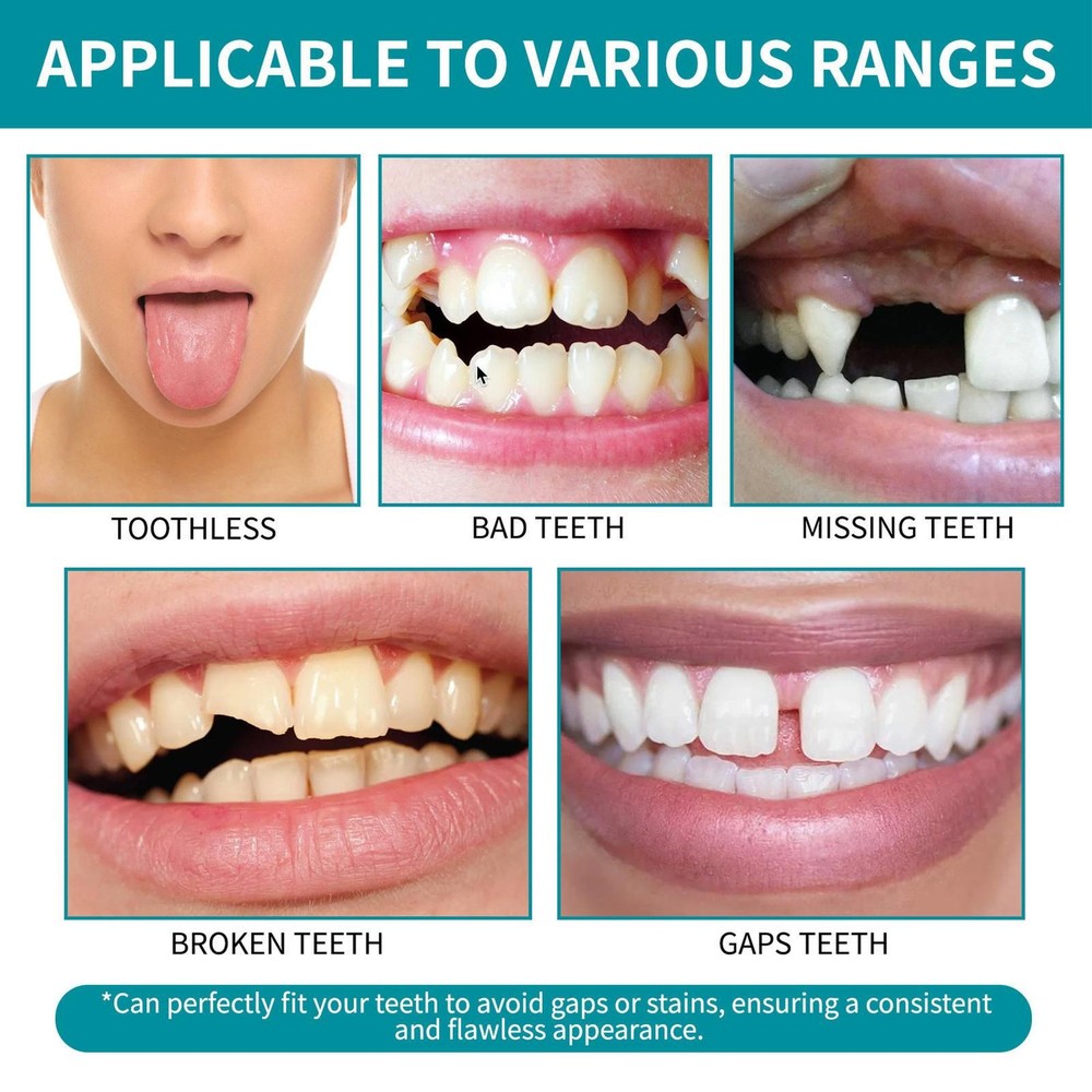 Teeth Dentures Tooth Replacement Set Upper And Lower Dentures For High Grade