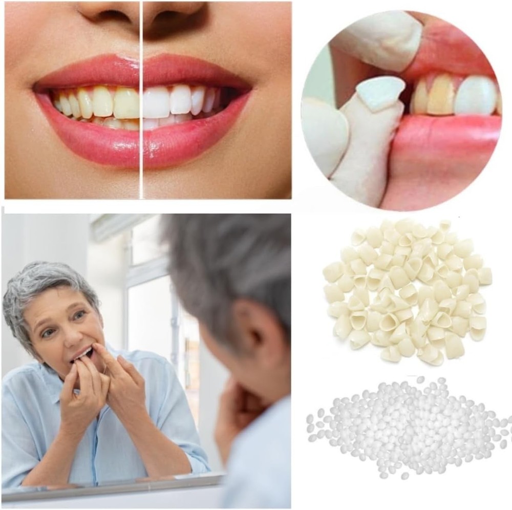 Temporary Teeth Crown Kit with Fitting Beads for Missing, Broken Teeth, Gaps, De