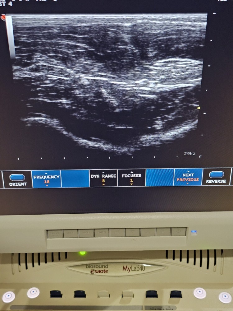 Esaote LA435 Linear Array Ultrasound Transducer Ref 9600173000