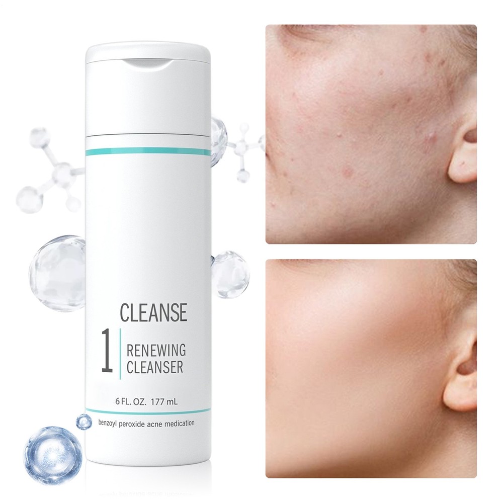 Proactiv 6oz Renewing Cleanser 60 Day Proactive Face Wash Solution New-